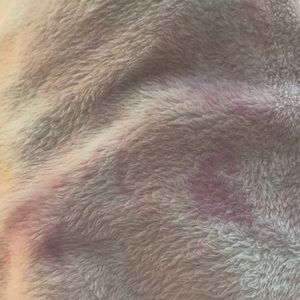 Meet your Posher, Fanta